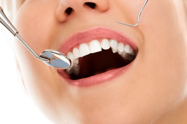 Dental Checkup: Full Exam of Teeth, Gums and Mouth - Thanasas