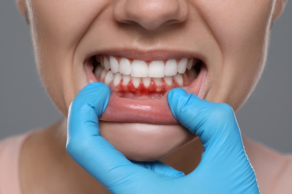 Periodontics And Dental Implants: How They Work Together